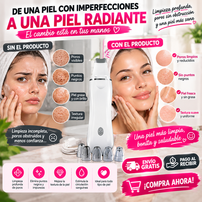 Limpiador Facial de Poros Recargable – ¡Limpia tu Piel en Profundidad y Luce un Rostro Más Fresco desde Casa!