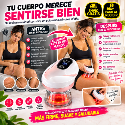 Masajeador Corporal con Succión y Calor – Ritual de Cuidado Anticelulítico